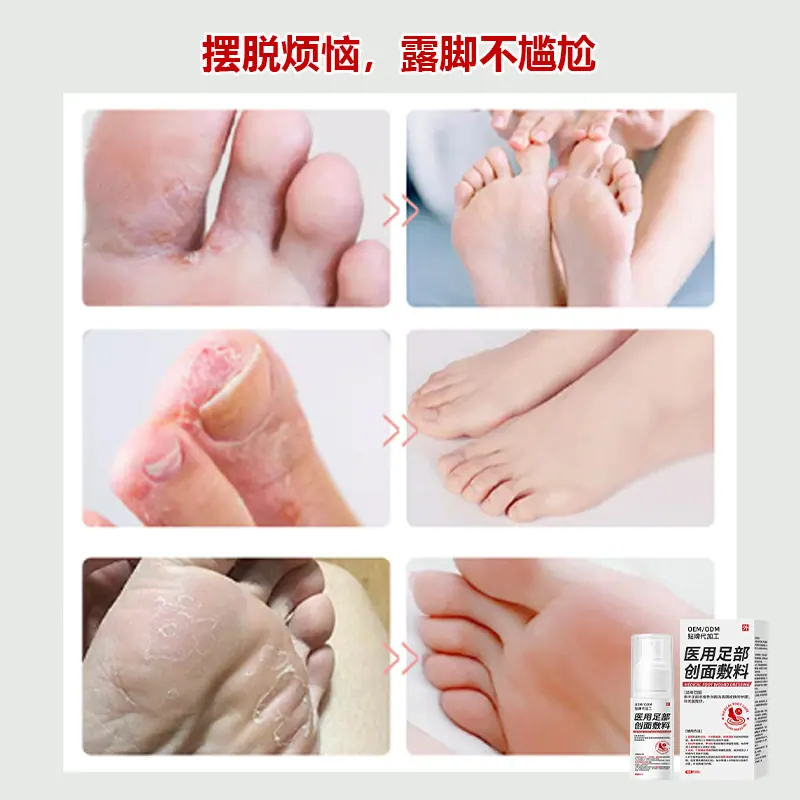 医用足部创面敷料主图3