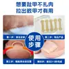 Pegatinas Populares Transfronterizas para Corrección de Uñas Encarnadas, Juego de Pegatinas para Corrección de Surcos de Uñas, Pegatinas para Corrección de Uñas