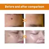 Ximonth Spray Suavizante de Veneno de Abelha Suave, Refrescante, Hidratante e Umectante para o Corpo