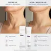 Xizhiyue Crema Hidratante para el Cuello Cuello Oscuro Smog Niacinamida Iluminadora Lifting Crema para el Cuello 20g Productos en Stock Transfronterizos