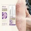 Spray para el Cuidado de la Piel Ximonth Piel del Cuerpo Calma Acné Suave Hidratante Cuidado de la Piel Cuidado Refrescante