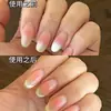 Pluma Esencia de Manicura Tres en Uno para Eliminar Piel Muerta, Manicura y Solución Nutritiva para Aceite de Borde de Uña, Aceite para Cuidado de Uñas Dañadas para Prevenir la Rotura