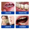 Solução Personalizada para Enxágue de Úlceras Bucais, Processada em Nome de Clientes, para Inflamação Bucal e Pós-Cirurgia de Prótese Dentária, Enxaguante Bucal de Grau Médico