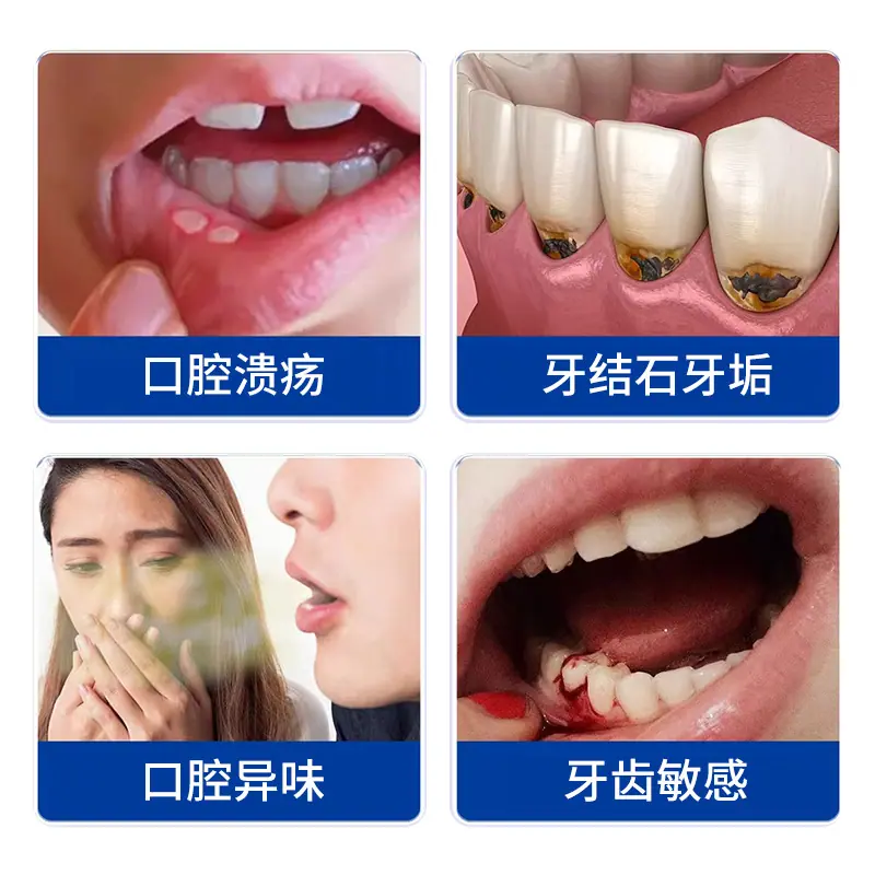 医用口腔含漱液2026 (3)