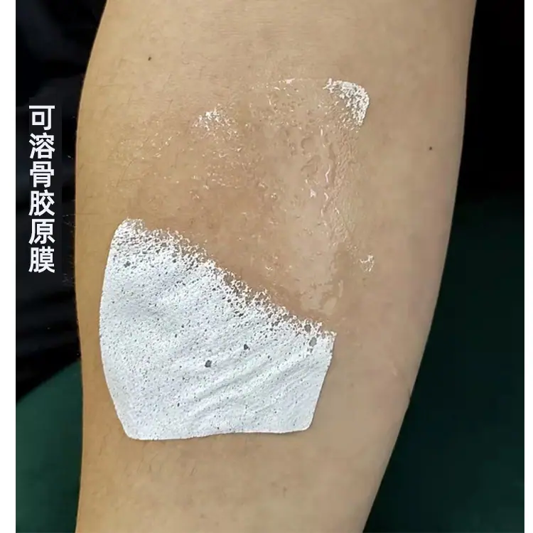 可溶骨胶原面膜1