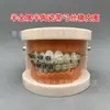 Modelo ortodôntico dental modelo autoligante de cermet oral display de comunicação médico-paciente ambulatorial modelo dental de ensino