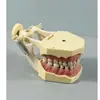 Modelo Dental Cepillado Oral Dentadura Postiza Boca Completa Dental Removible Encía Suave Transparente Implante Resina Preparación Dental Molde Dental