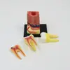 Suministro Juguetes Ensamblados Dientes Humanos Modelo Ensamblado Modelo de Anatomía de Órganos Enseñanza Médica Bricolaje Electrodomésticos de Ciencia Popular