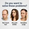 Esencia para el Cuidado del Cabello Roll-On 30ml Esencia Nutritiva para el Cuidado del Cabello Sérum para el Crecimiento del Cabello Roll