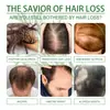 Aceite Esencial de Romero Ouhoe para el Cabello Cuidado Diario y Aceite Hidratante para el Cuidado del Cabello para un Cabello Suave y Liso