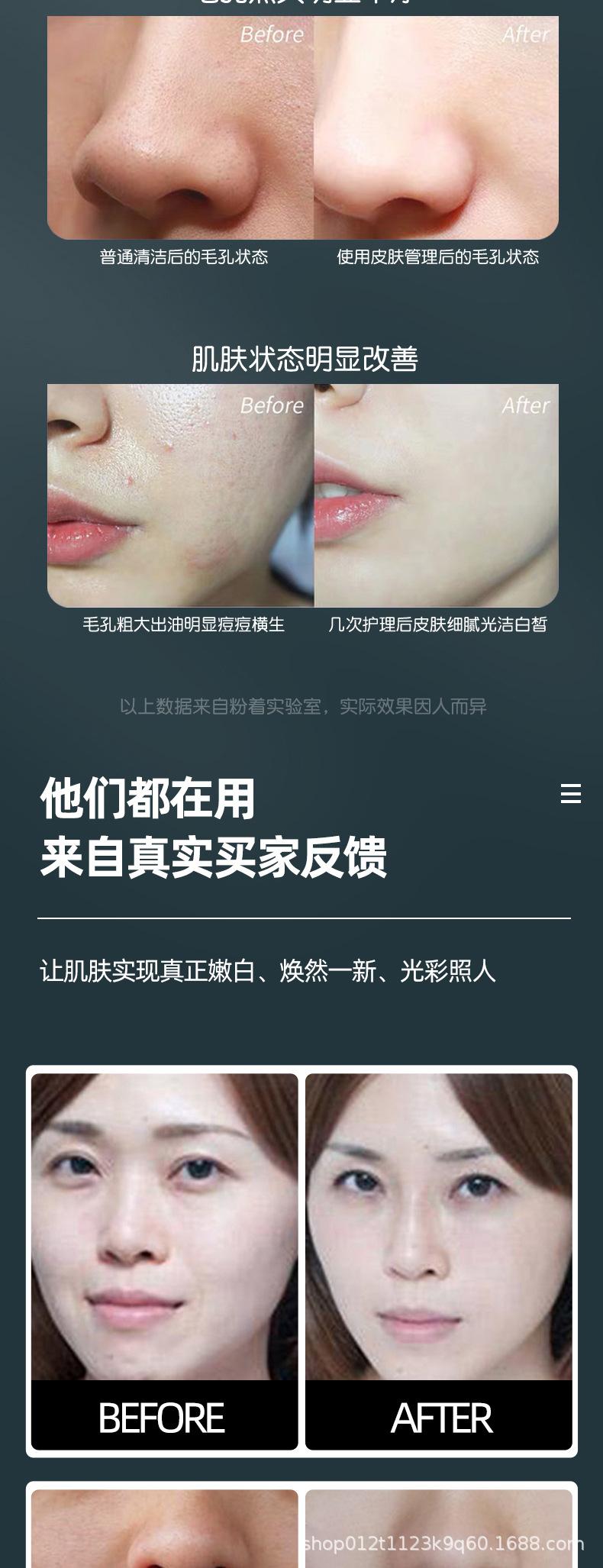 魔法活氧泡泡机美容仪