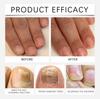 OUHOE Solución para el Cuidado de las Uñas suit Mejorar Uña Suave Hidratación de Uñas Reparación de Cutículas Agente para el Cuidado de la Superficie de la Uña