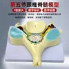 Modelo Magnificado de la Columna Cervical y los Nervios Espinales de la Quinta Vértebra Cervical. Modelo Magnificado de Columna Cervical y Sección Transversal de la Médula Espinal Estructura de la Médula Espinal