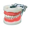 Modelo de Enseñanza de Modelo Dental de Comercio Exterior, Modelo Desmontable de Preparación Dental e Implante con Encías Suaves, Marco de Mandíbula Dp 32