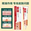 Crema Antipicazón, Crema Antibacteriana Fukang, Piel Antipicazón, Manchas Rojas, Picazón Húmeda, Alivio de la Sequedad y Crema Antipicazón al por Mayor