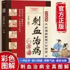 Um Guia Abrangente sobre Sangria na Medicina Tradicional Chinesa para o Tratamento de Doenças: uma Edição Ilustrada Colorida de Técnicas de Sangria para Saúde e Bem-Estar, Removendo Estagnação e Desbloqueando Meridianos - Livro Autêntico