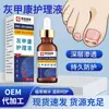 Solución para el Cuidado de la Onicomicosis Farmacéutica Yingmei, Líquido para Onicomicosis, Líquido Espeso para Iluminar Uñas Gruesas, Líquido Especial para Onicomicosis, Venta al por Mayor y Entrega por Fabricante