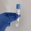 Tubo de Recolección de Sangre para Separación de Suero PRP de Belleza Tubo de Belleza Médica Microcirugía 10ml Extracción Estéril de Plasma Plaquetario