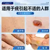 Gel Removedor de Verrugas Médico, Creme Removedor de Verrugas, Gel para HPV para Pequenas Marcas de Pele no Pescoço, Pomada Removedora de Verrugas, Creme Removedor de Verrugas