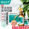 Líquido especial para crescimento de onicomicose à base de ervas de Yunnan Líquido antibacteriano para unhas unha brilhante unha cinza líquido espessante creme removedor de unhas moles