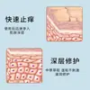 Piel de Vaca Gel Médico Antipirético Tinea Oem Procesamiento Oem Dermatitis Urticaria Húmeda Rash de Cáñamo Plateado Picazón en la Piel Crema Personalización