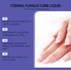 Esencia Ximonth para el Cuidado de las Uñas Solución Nutritiva Suave para el Cuidado Diario de Uñas de Manos y Pies