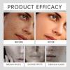 Esencia Hidratante OUHOE para la Piel Facial Hidratante e Hidratante Nutritiva Suave e Hidratante Profunda Reafirma la Piel