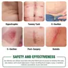 Hojas de Silicona Transfronterizas para Cicatrices, 1.5m de Longitud, Calmante para Piel con Cicatrices, Cuerpo, Cinta de Hoja de Silicona para Cicatrices