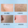 Leite de Limpeza Suave Qise Youth Aminoácido Suave Não Puxa Remoção de Cravos Controle de Oleosidade Refrescante Hidratante Limpador Facial