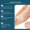 Creme para Cuidados com as Pernas Houkea Cuidado Suave Massagem Pernas Nutritivo Xadrez Creme de Manutenção Externa