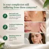 Crema Iluminadora Correctora de Manchas Oscuras Transfronteriza 50ml