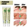 Sumifun Ungüento Purificante Herbal para la Piel Crema de Cuidado Receta Secreta de la Familia Miao 20g Crema para el Cuidado de la Piel Ungüento Transfronterizo K10328