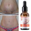 KORMESIC Aceite esencial para el cuidado abdominal Shui Yang Aceites esenciales corporales fabricantes de comercio exterior transfronterizo al por mayor