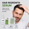 Sistema de Crescimento Capilar Microneedle para Crescimento Capilar Kit de Cuidados Capilares Essência