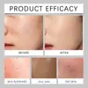 East Moon Corretivo Masculino Creme Hidratante Reparador Leve Longa Duração Pele Hidratante Iluminador Corretivo Creme Hidratante