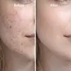Essência de Peptídeo de Cobre Azul Transfronteiriça 30ml GHK-Cu Essência Hidratante de Reparo Profundo Essência Multi-Peptídeo