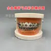 Modelo ortodôntico dental modelo autoligante de cermet oral display de comunicação médico-paciente ambulatorial modelo dental de ensino