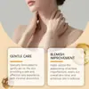 Hidratante Masaje Suave Nutrir Suavizar Piel del Cuerpo Limpieza Especialmente Limpieza de Lunares Negros Cuidado de la Piel Crema Corporal