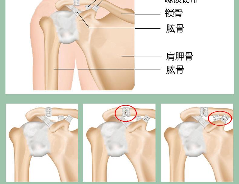单肩2.jpg