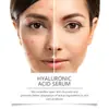 Eu Cpsr Producto Popular Hoygi Esencia Roller de Ácido Hialurónico para Hidratación, Nutrición, Aplicación y Masaje de la Piel Facial
