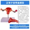 Modelo de útero feminino médico modelo de estrutura reprodutiva ovariana modelo de anatomia ginecológica Obstetrícia e Ginecologia modelo de útero ovariano