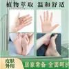 Producto Más Vendido de 2026: Venta al por mayor del fabricante Hong Kong Rey del Hongo Crema Hidratante Herbal para Piel de Manos y Pies Secos, Agrietados y Descamados, Crema Antibacteriana y Anti-Picazón