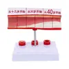 Boyou Modelo Vascular Modelo Médico Simula Modelo de Vaso Sanguíneo Humano Bloqueio de Vaso Sanguíneo Treinamento de Vaso Sanguíneo