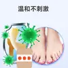 Parches para Uñas Estilo Guangdong al por Mayor para Engrosar Surcos de Uñas, Tratar Onicomicosis, Callosidades, Durezas y Uñas Encarnadas, Parches de Cuidado, Transmisión en Vivo, En Stock