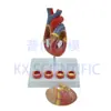 Pnt-0724 Modelo de Corazón 4 Etapas Vaso Sanguíneo Patología Arterial Anatomía Cardíaca Cardiovascular Pantalla Materiales Didácticos