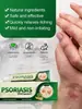 Comercio exterior transfronterizo Amazon AliExpress crema antibacteriana de hierbas a musgo para el cuidado de la piel antipruriginosa