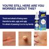 Spray para Eliminar Verrugas Transfronterizo Hbesty, Solución para el Cuidado y Eliminación de Verrugas, Solución para el Cuidado de Callos y Verrugas Plantares