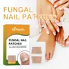 Ximonth Patches de Cuidado para Unhas Suaves, Refrescantes, Brilhantes, Estáveis, Sedosos, Macios e Clareadores Patches de Cuidado para Unhas