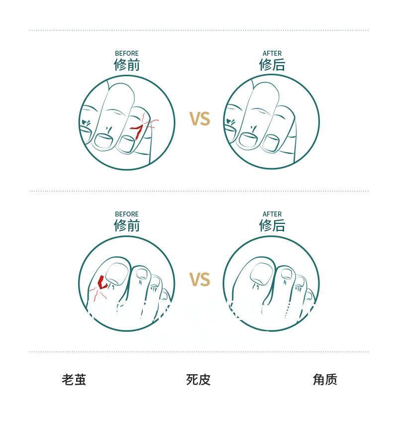 死皮-推_02.gif