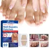 Patch Ximonth para Cuidado das Unhas, Unhas Macias e Bem Cuidadas para Mãos e Pés, Confortável, Fresco, Respirável e Adequado para Cuidado